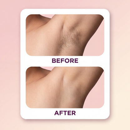 Razor-Free Hair Removal Spray