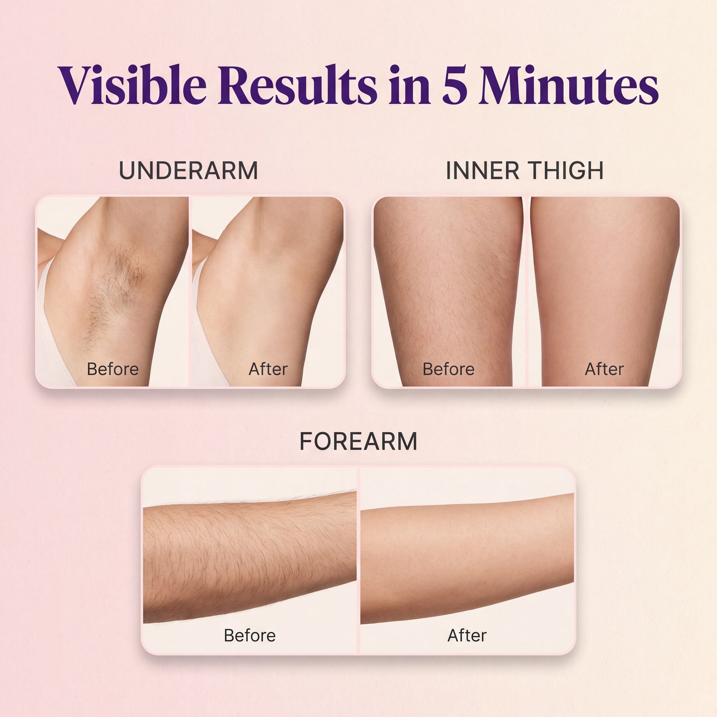 Razor-Free Hair Removal Spray
