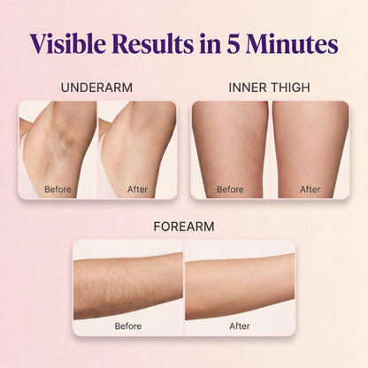 Razor-Free Hair Removal Spray
